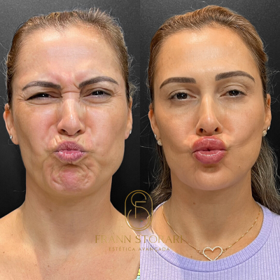 Rejuvenescimento